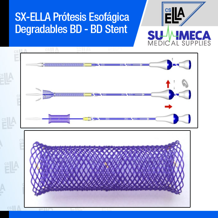 Prótesis Esofágica Biodegradable BD - Imagen 3