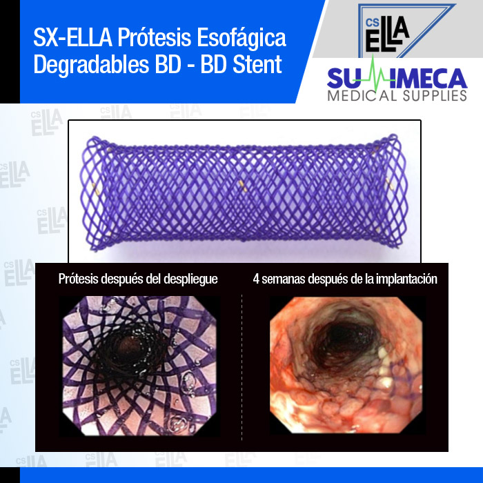 Prótesis Esofágica Biodegradable BD - Imagen 5