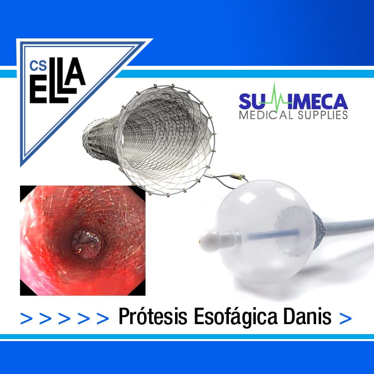 Prótesis Esofágica Danis - Imagen 4