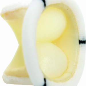 Válvula Biológica de Pericardio Bovino — Braile