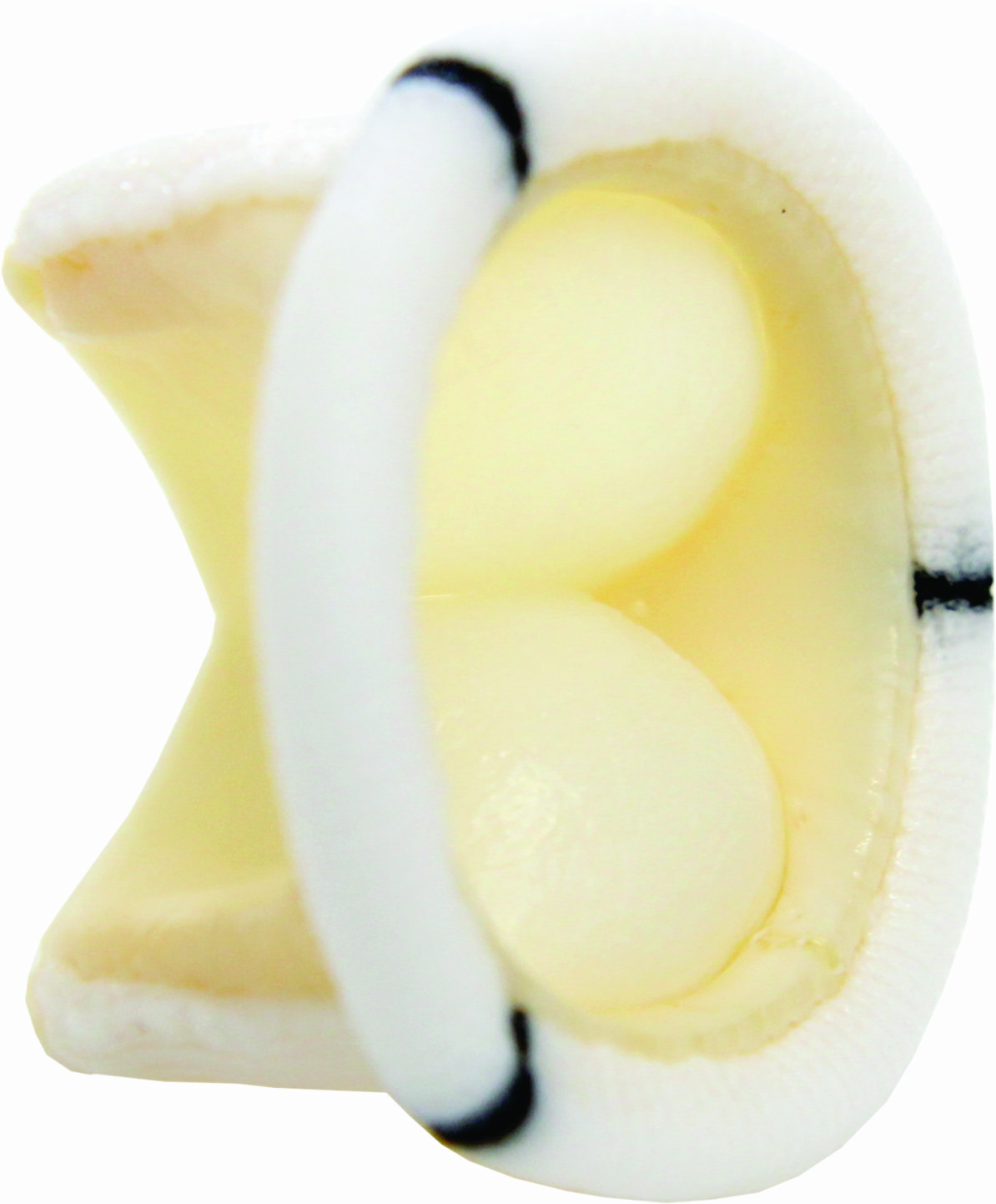 Válvula Biológica de Pericardio Bovino — Braile